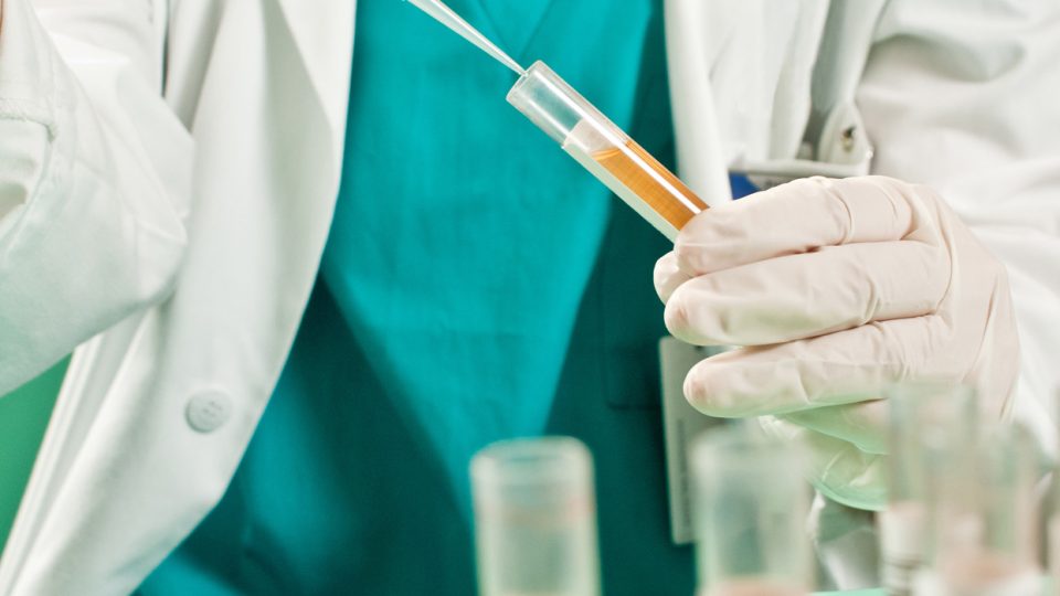 Does CBD Show Up on a Drug Test?