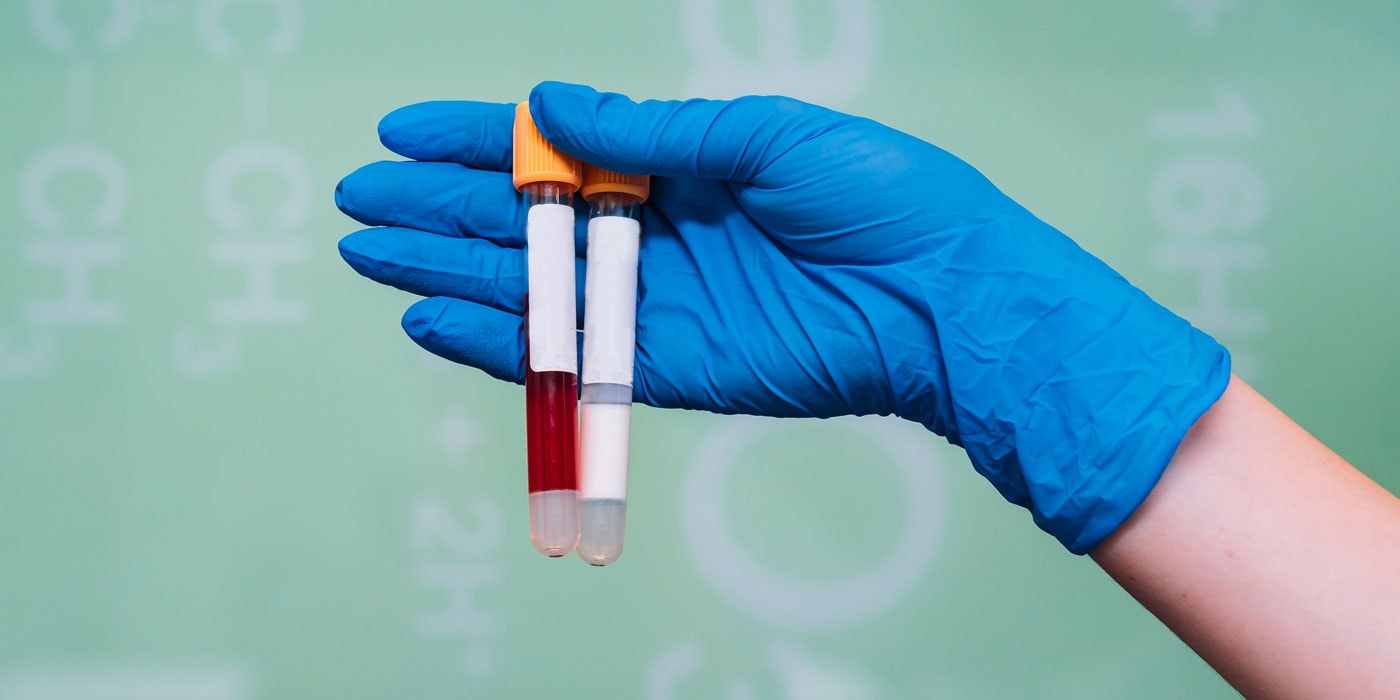 A close-up of a person in a lab coat wearing gloves and holding a test tube to complete a drug test.